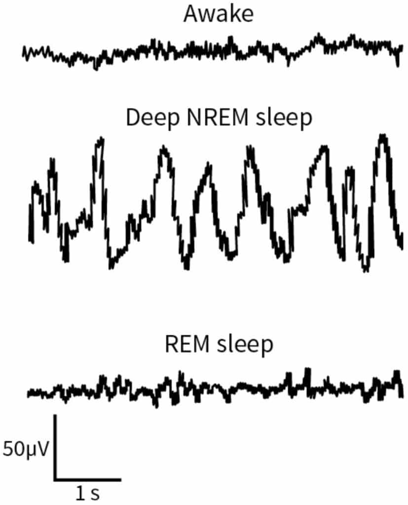 When we sleep